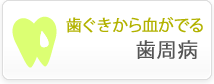 歯ぐきから血が出る　歯周病